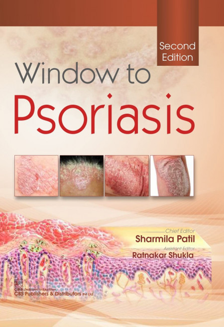 Window to Psoriasis, 2/e Hardcover – 1 January 2021 Window to Psoriasis, 2/e Hardcover – 1 January 2021