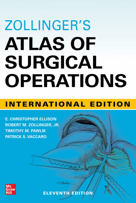 Zollinger's Atlas of Surgical Operations, Eleventh Edition Hardcover – 25 November 2021