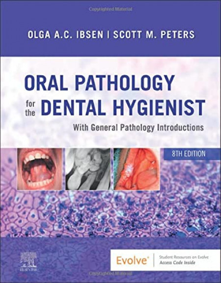 Oral Pathology for the Dental Hygienist: With General Pathology Introductions
