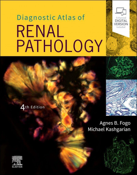 Diagnostic Atlas of Renal Pathology Hardcover – 7 December 2021