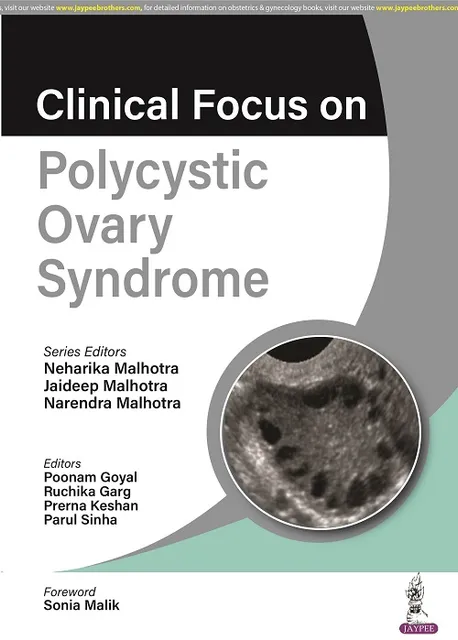 Clinical Focus on Polycystic Ovary Syndrome 1st Edition 2023 by Neharika Malhotra